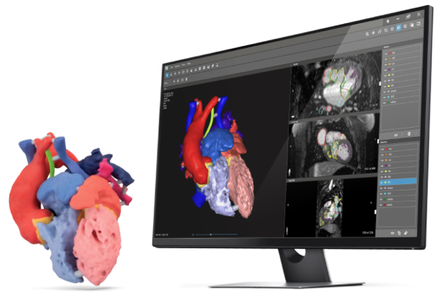 Software de segmentación de imágenes médicas en 3D
